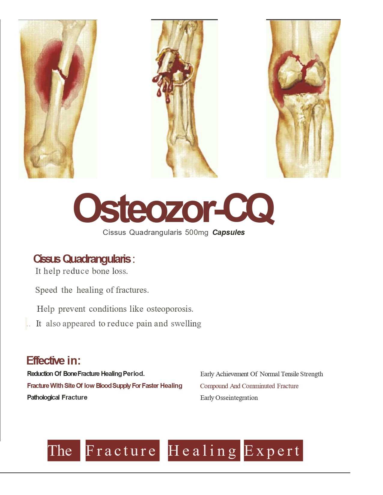 Osteozor-CQ